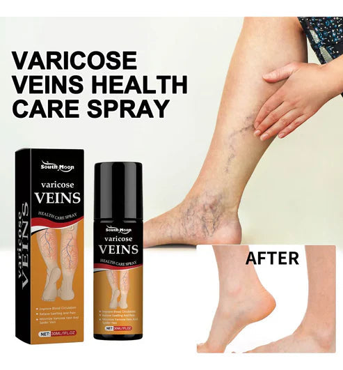 BEE VENOM VARICOSE VEINS RELIEF SPRAY (BUY 1 GET 1 FREE)(PACK OF 2)